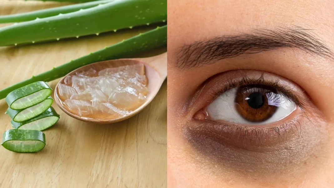 Aloe Vera For Dark Circles