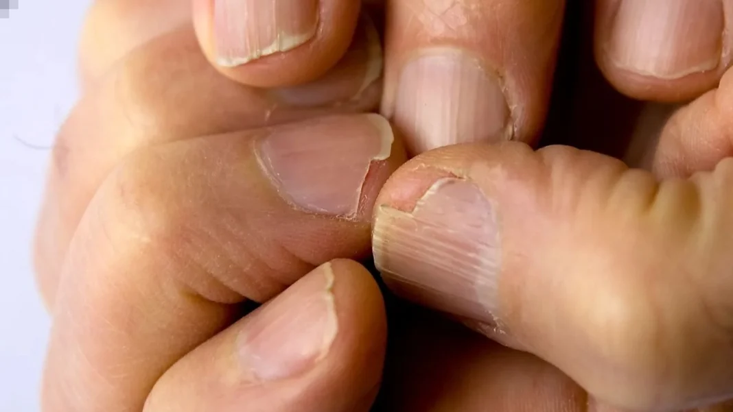 Tips for Dry Nails